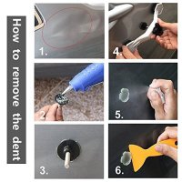 QUIXX Dent removal kit